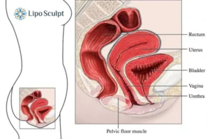 Treatment For A Leaky Bladder 2 How EM Chair treatment Keighley can help Leaky bladder issues. Read more now!